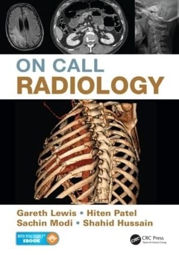 On Call Radiology, Lewis, Modi, Patel, Hu 9781482221671 Fast Free Shipp..
