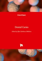 Efka Zabokova Bilbilova | Dental Caries | Buch | Englisch (2021) | Gebunden