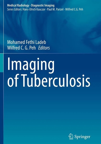 Mohamed Fethi Ladeb (U. A.) | Imaging Of Tuberculosis | Taschenbuch | Englisch-image