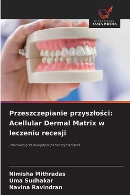 Przeszczepianie przyszloci: Acellular Dermal Matrix w leczeniu recesji by Nimish