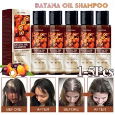 Batana Oil Shampoo for Hair Growth Healthier Thicker Fuller Repair Damaged Hair