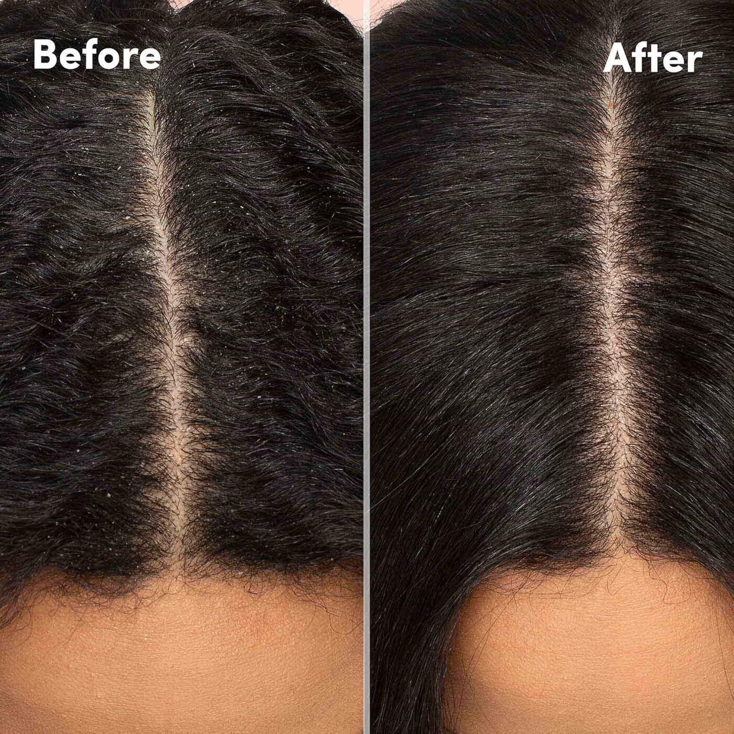 Mizani Scalp Care Calming Scalp Lotion 4oz