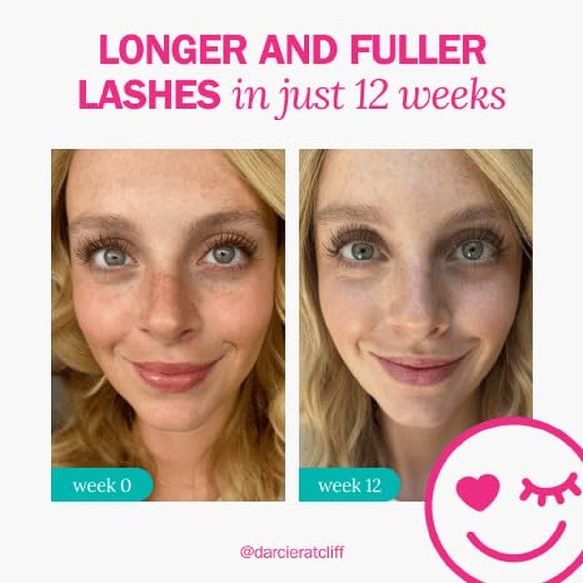 fLASH Eyelash Serum for Long, Curled Natural Lashes - Enhances