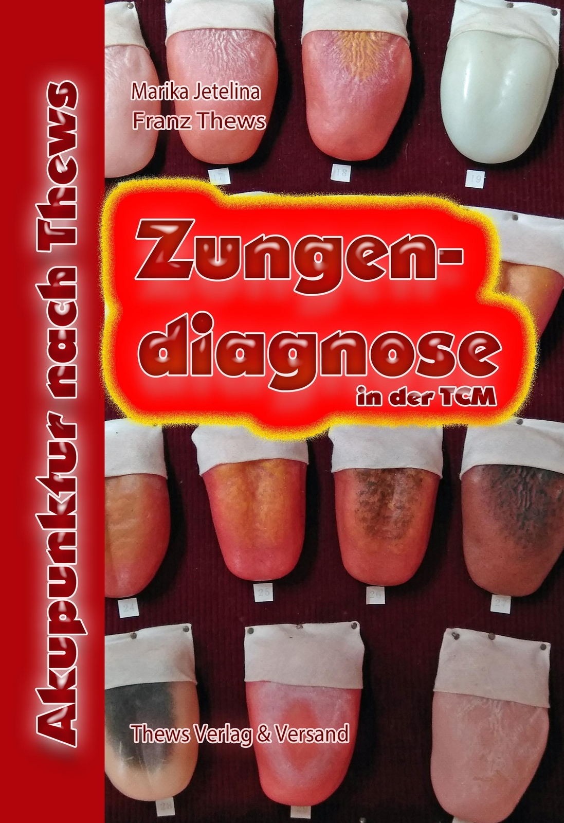 Thumbnail - Zungendiagnose In 54 Bildern Traditionelle Chinesische Medizin Thews