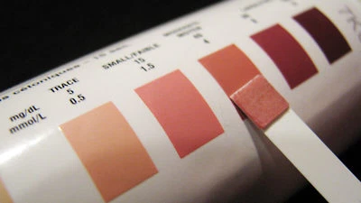 MEDIMAD 60 x KETONE URINE REAGENT STRIP TESTS ATKINS KETOSIS DIET WEIGHT LOSS