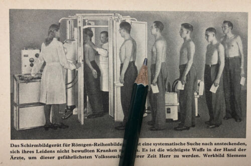 Weiße Pest Tuberkulose TBC Röntgen Lunge 1950 Lügendetektor Wahrheitsspritze 186 - Bild 1 von 8