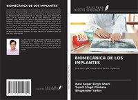 Ravi Sagar Singh Shahi (U. A.) | BiomecÁNica De Los Implantes | Taschenbuch
