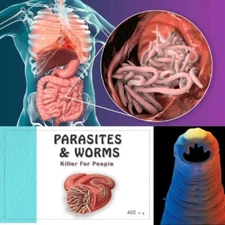 PARASITE DETOX BODY CLEANSE Complex Anti- PARASITE Support Cleanse Kills Worms