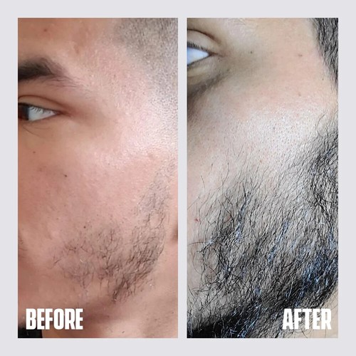 Champú para crecimiento de barba totalmente cafeinado para vello facial 120 ml - Imagen 3 de 7