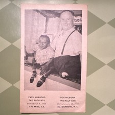 Carl Norwood The Frog Boy & Dick Hilburn The Half Man Circus  Photo Postcard