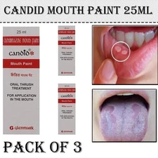 3 X Candid Mouth Pain For Oral Thrush Treatment For Kills Fungal Infection