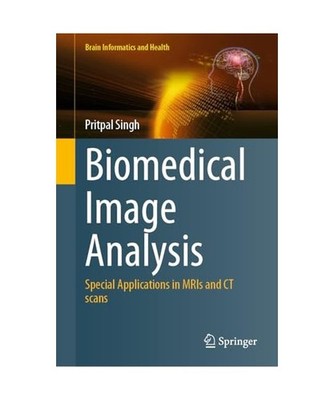 Biomedical Image Analysis: Special Applications in MRIs and CT scans 