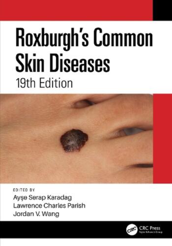 Roxburgh's Common Skin Diseases by Jordan V. Wang Hardcover Book - Afbeelding 1 van 1