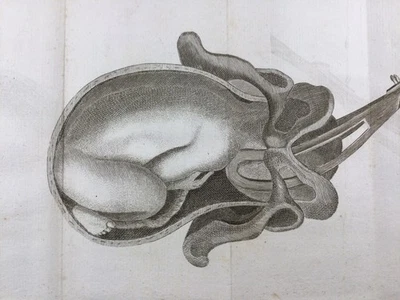 Gynécologie Obstétrique en 1807 Rare Gravure L’art des Accouchements Médecine - Photo 1/3