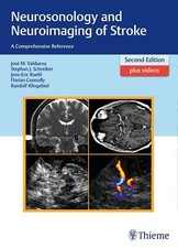 Neurosonology and Neuroimaging of Stroke | Jo...