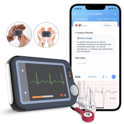 AI EKG Monitor Touch Screen for Family use w AI Analysis 30s/60s/5mins Recording