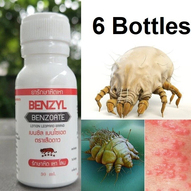 Scabies sale treatment cream