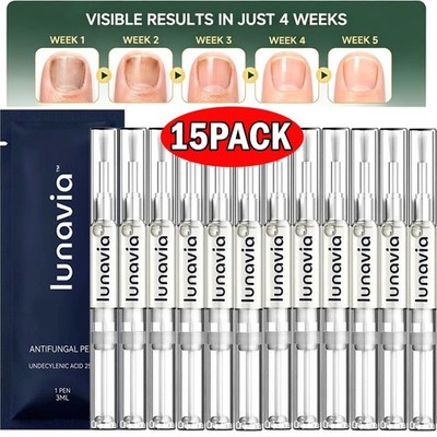 15 Pack Lunavia Antifungal Pen, 25% Undecylenic Acid   Toenail Fungus Treatment