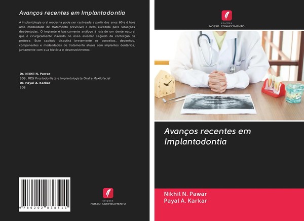 Nikhil N. Pawar (U. A.) | AvançOs Recentes Em Implantodontia | Taschenbuch-image