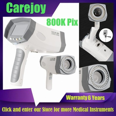 Medical Digital Video Electronic Colposcope 800K Pixels Camera With Software