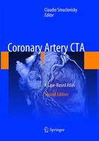 Claudio Smuclovisky | Coronary Artery Cta | Taschenbuch | Englisch (2019) | Xii