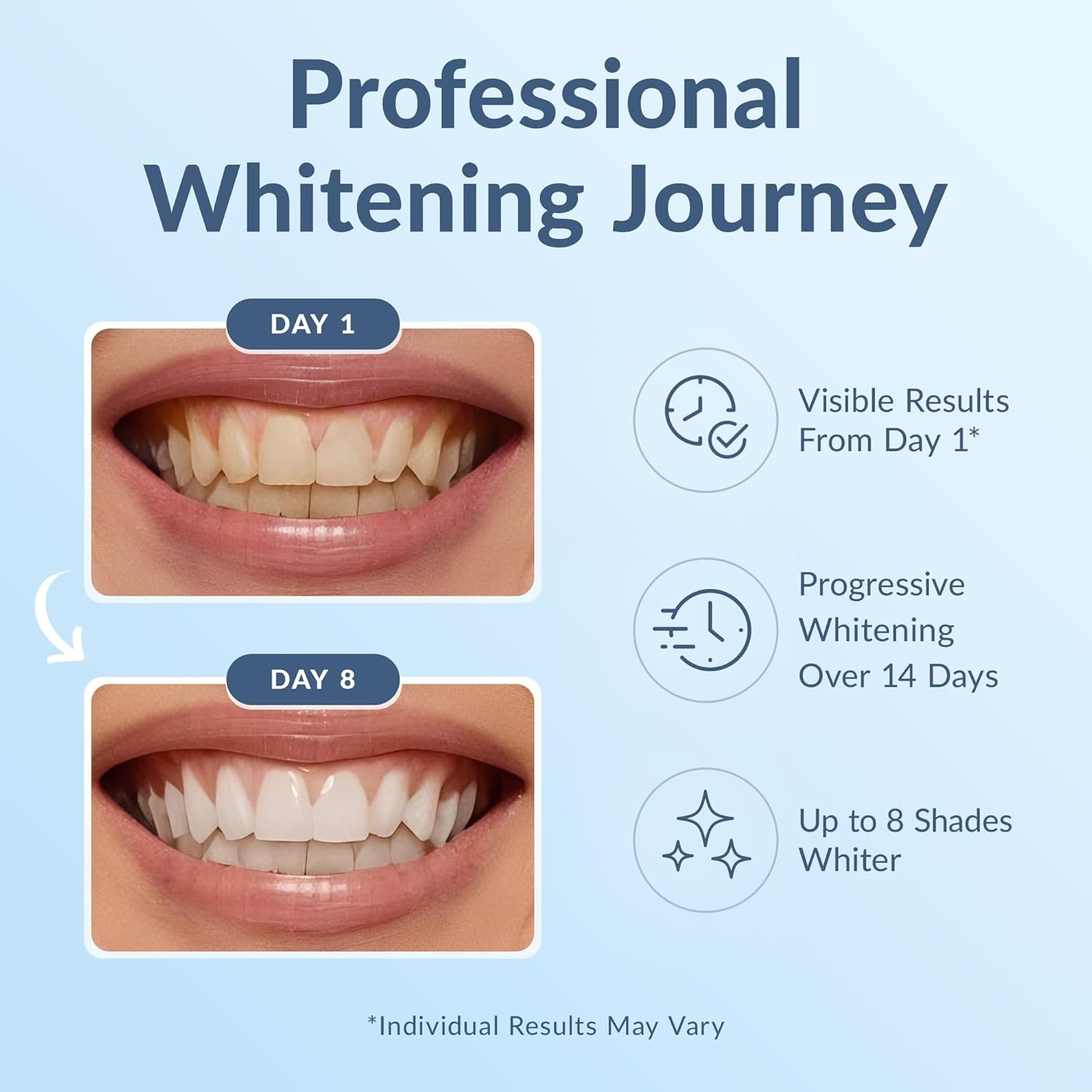 DR.DENT Professional Teeth Whitening Strips - Pack of 20 Strip - 10... 
