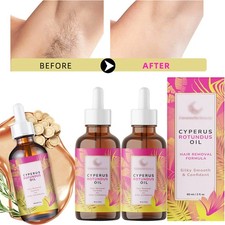 1-5PCS Cyperus Rotundus Oil - 60ml Natural Cyperus Rotundus Oil For Hair Removal