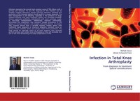 Michele Vasso (U. A.) | Infection In Total Knee Arthroplasty | Taschenbuch