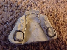 Sample orthodontic appliances retainers Educational Models Sells Dentistry