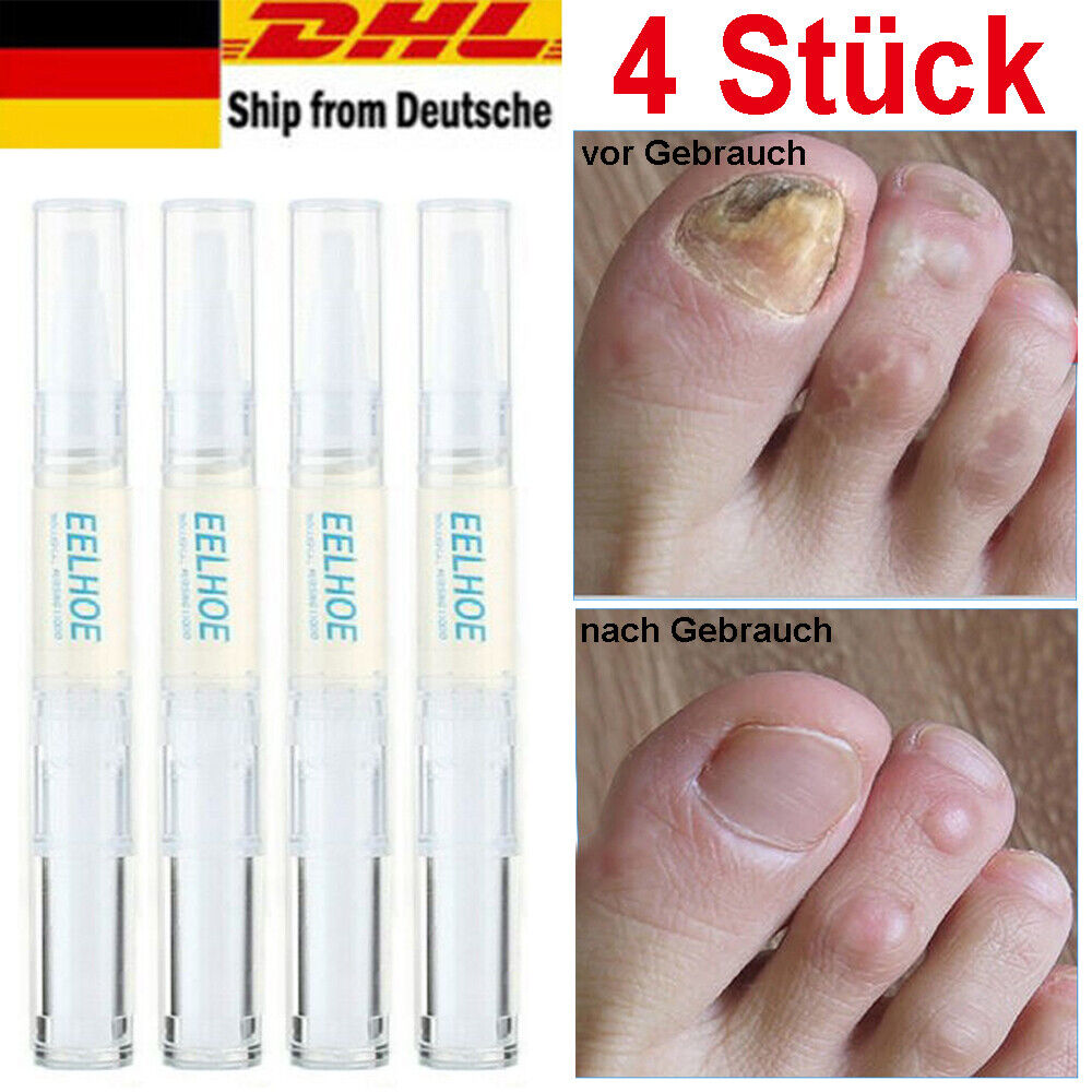 4 stk Anti Nagelpilz Stift Nagelpilz Behandlung Nagelpflege Nagelreparatur stift