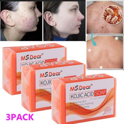 MS DEAR Kojic Acid Soap Dark Skin Whitening Bleaching Lightening Brightening Face & Body