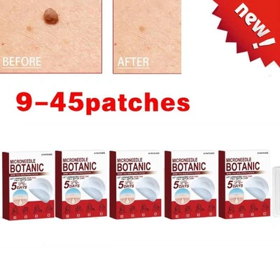 9-45x MICRONEEDLE BOTANIC Skin Tag & Acne Patch Skin Tag Remover Patche s