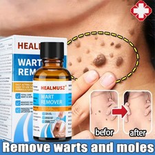 Wart Remover Liquid Skin Tag Mole Remover Eliminate Feet Corn Wart Remove Liquid