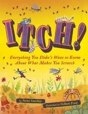 Itch!: Everything You Didn't Want to Know About What Makes You Scratch: Sanchez