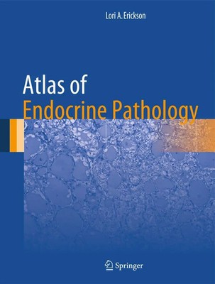 Lori A. Erickson | Atlas of Endocrine Pathology | Buch | Englisch (2014) | xi