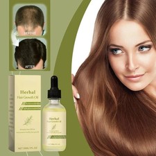 Herbal Hair Growth Oil Moisturizing and Repairing Hair Anti Hair Loss Essence