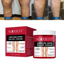 Varicose Veins Relief Cream Relieve Tired Legs Spider Pain Tighten Smooth Skin