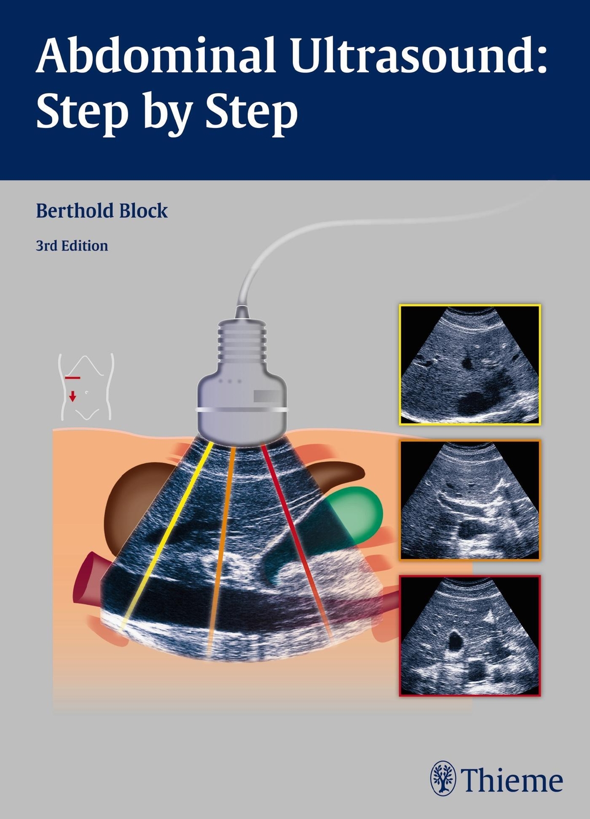 Thumbnail - Abdominal Ultrasound: Step By Step | Berthold Block | Englisch |