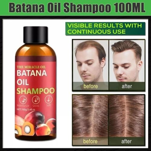 Hair Growth Shampoo Nourishing Roots Loss DHT Blocker Stop Alopecia! 100ml - Picture 2 of 11