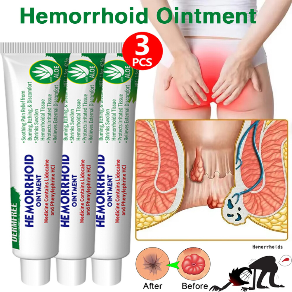 3PCS Hemorrhoids Remove Ointment Herbal Cream Relief Piles Pain Reduce Itching