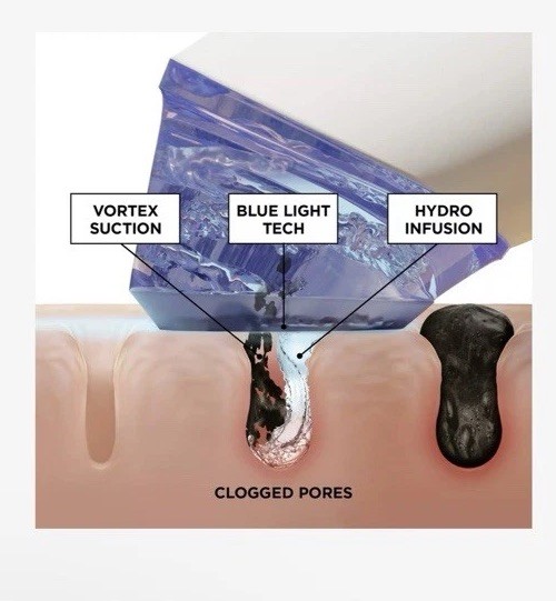 BeautyBio Glofacial Hydro-Infusion Pore