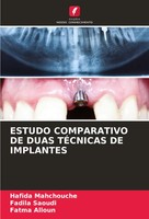 Hafida Mahchouche (U. A.) | Estudo Comparativo DE Duas TÉCnicas DE Implantes