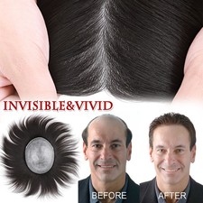 Mens Hair Replacement Ultra Thin Skin Toupee Hairpieces PU/NPU/MONO System Wigs