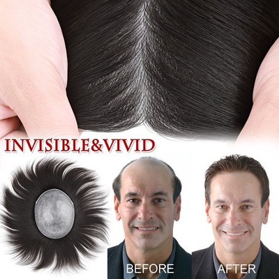 Mens Hair Replacement Ultra Thin Skin Toupee Hairpieces PU/NPU/MONO System Wigs