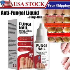 Fungi-Nail Anti-Fungal Liquid Solution Kills Fungus That Can Lead To Nail