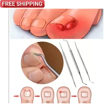 3PCS Stainless Steel Ingrown Toenail Tool Kit - Double Sided Pedicure Nail File