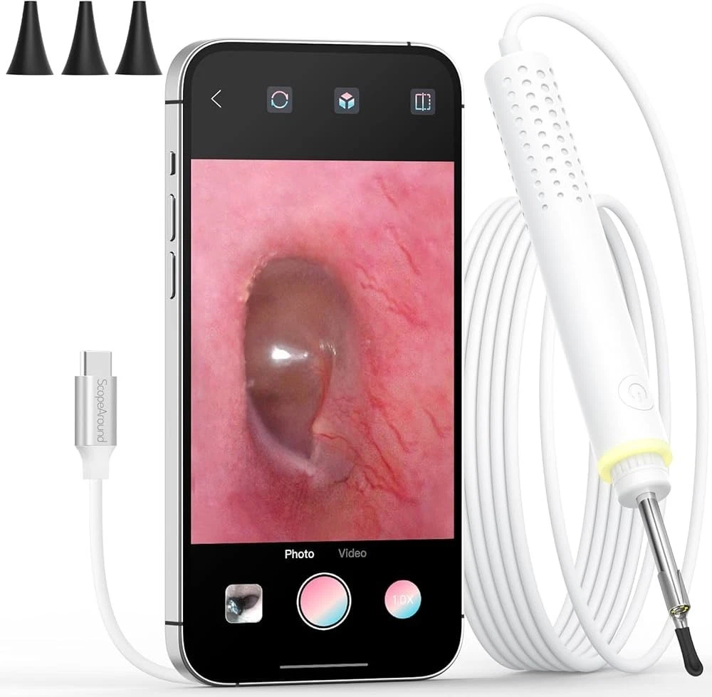 ScopeAround Otoscope Ear Cleaning Camera - Thumbnail 4