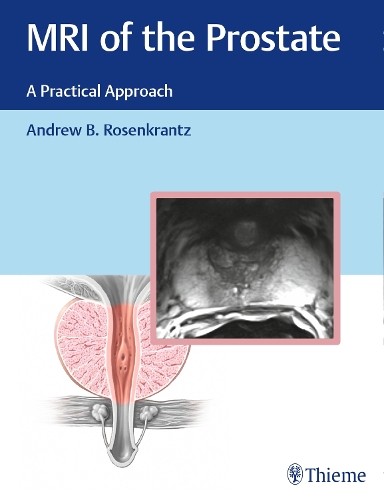 MRI of the Prostate – A Practical Approach Rosenkrantz Hardback MM – Thieme