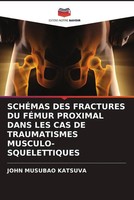 John Musubao Katsuva | SchÉMas Des Fractures Du FÉMur Proximal Dans Les Cas...