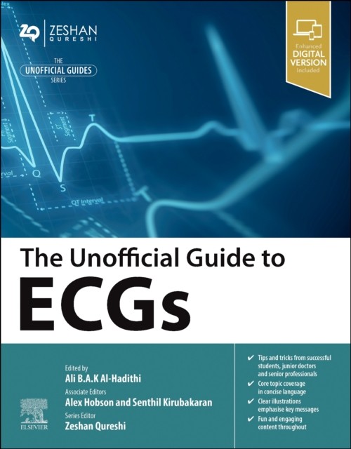 The Unofficial Guide to ECGs by B01 (Paperback Book)